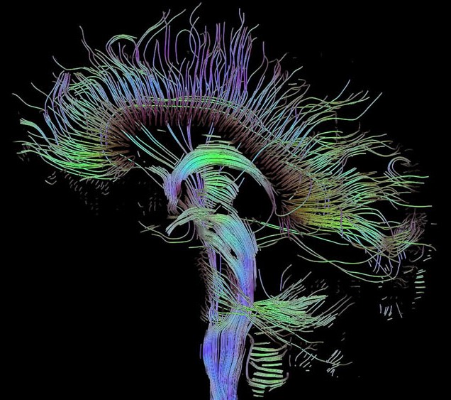 cerveau-humain